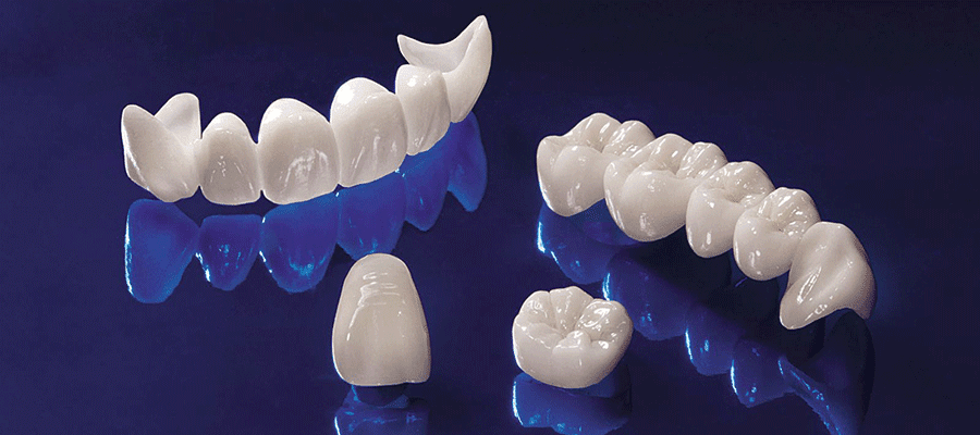 Zirkonyum Kaplama Fiyatları 2024 | İdea Dental Clinic