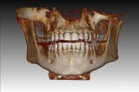 Dental Tomografi Nedir? Avantajları Nelerdir? - Trakyadent